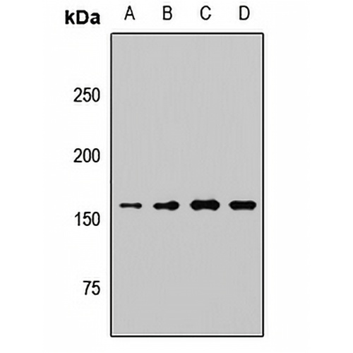 KDM6A Rabbit Polyclonal Antibody