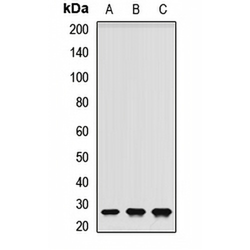 RNF166 Rabbit Polyclonal Antibody