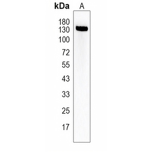 PALB2 Rabbit Polyclonal Antibody
