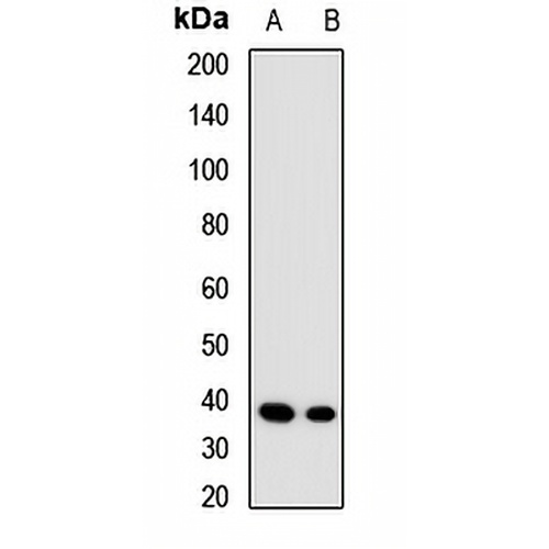 ALAD Rabbit Polyclonal Antibody