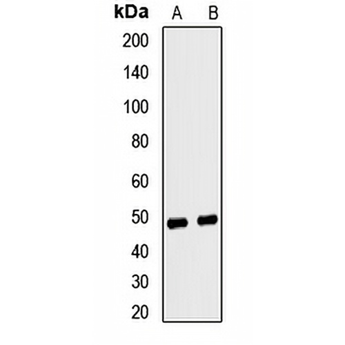 Ferrochelatase Rabbit Polyclonal Antibody
