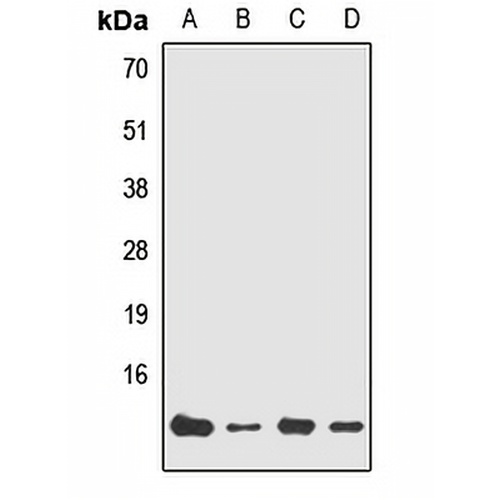 NDUFA7 Rabbit Polyclonal Antibody