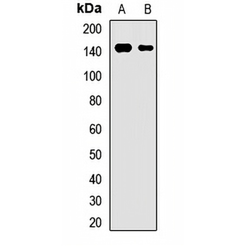 BSEP Rabbit Polyclonal Antibody