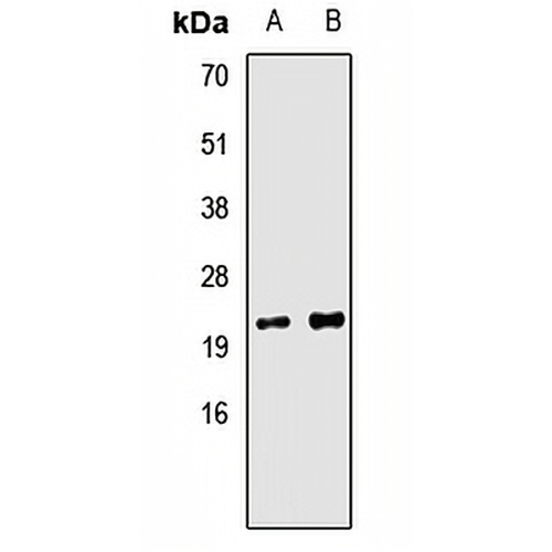 Tim9B Rabbit Polyclonal Antibody