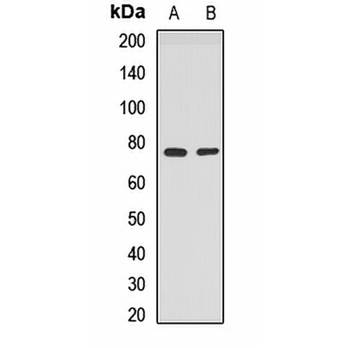 PPP2R3B Rabbit Polyclonal Antibody