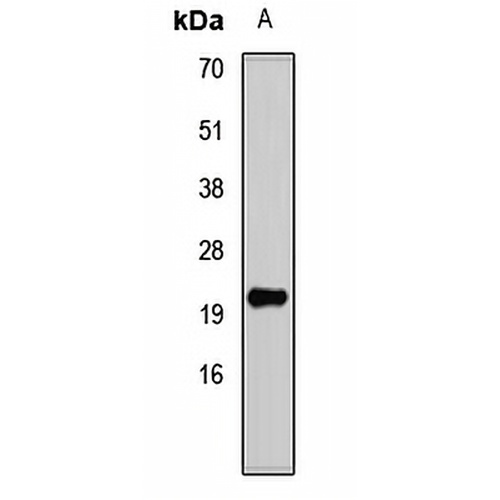 DNA Polymerase delta 4 Rabbit Polyclonal Antibody