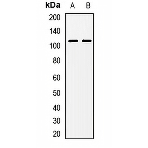 NAA25 Rabbit Polyclonal Antibody