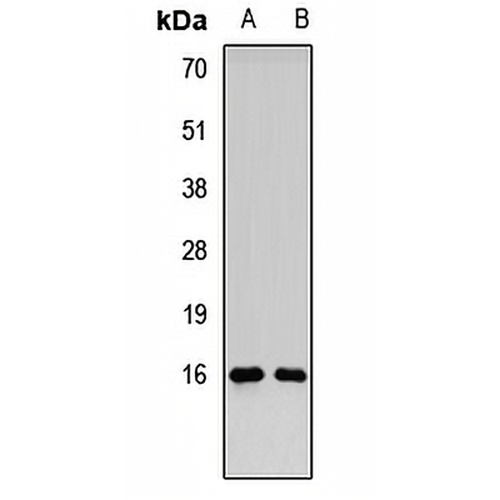 RMI2 Rabbit Polyclonal Antibody