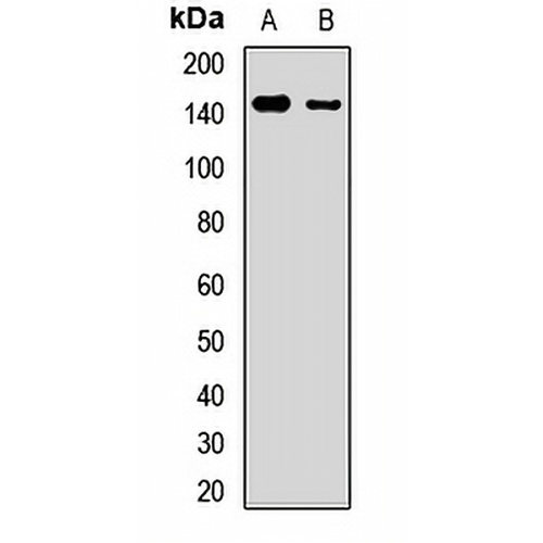 ULK1 Rabbit Polyclonal Antibody