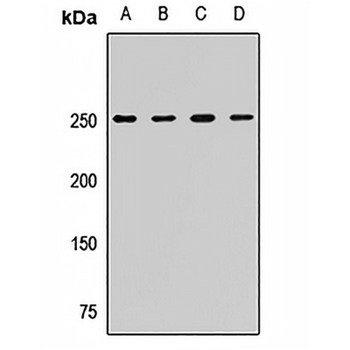 CKAP5 Rabbit Polyclonal Antibody