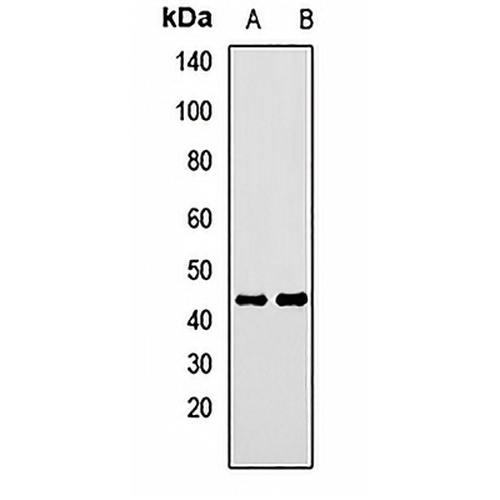 CALCRL Rabbit Polyclonal Antibody