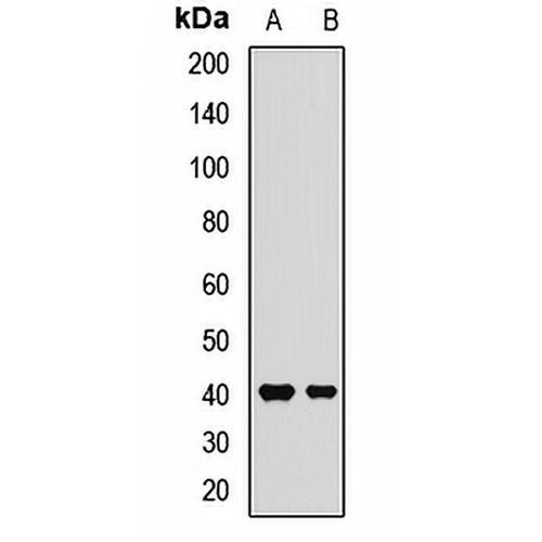 FcRn Rabbit Polyclonal Antibody
