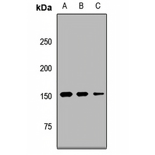 UTY Rabbit Polyclonal Antibody