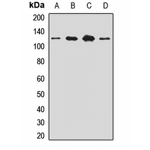 SART1 Rabbit Polyclonal Antibody