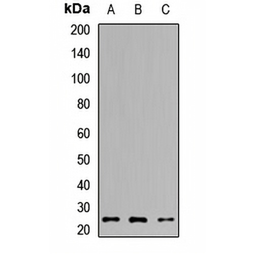 TPPP Rabbit Polyclonal Antibody
