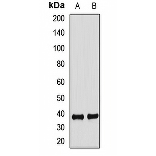 FBXO2 Rabbit Polyclonal Antibody