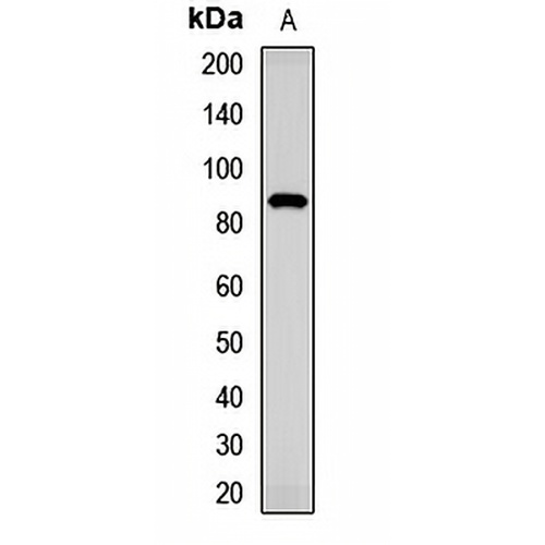 TMC1 Rabbit Polyclonal Antibody