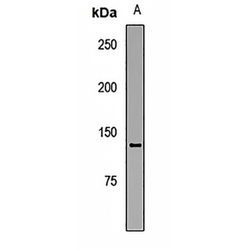 HFM1 Rabbit Polyclonal Antibody