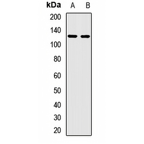 KIFC3 Rabbit Polyclonal Antibody
