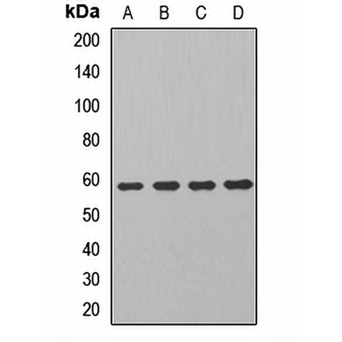 ALDH7A1 Rabbit Polyclonal Antibody