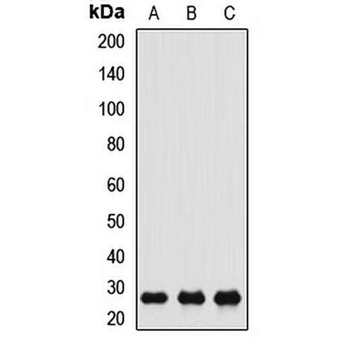 CACYBP Rabbit Polyclonal Antibody
