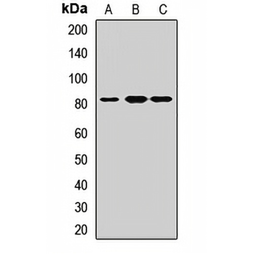 BBS10 Rabbit Polyclonal Antibody