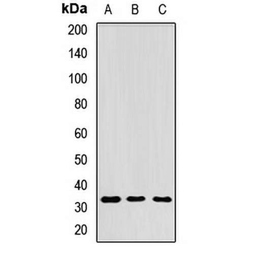 RPIA Rabbit Polyclonal Antibody