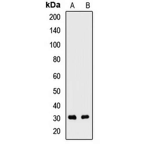 SNRPB2 Rabbit Polyclonal Antibody