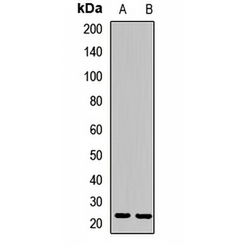 Prefoldin 3 Rabbit Polyclonal Antibody