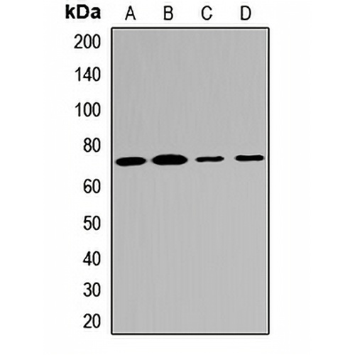 MTMR2 Rabbit Polyclonal Antibody