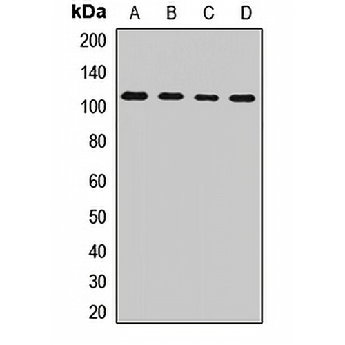 TFIP1 Rabbit Polyclonal Antibody