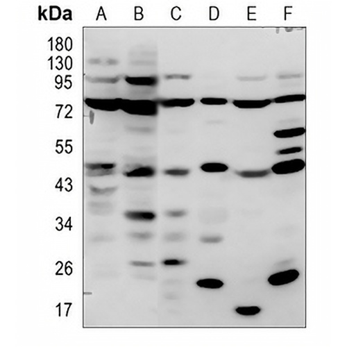 OST48 Rabbit Polyclonal Antibody