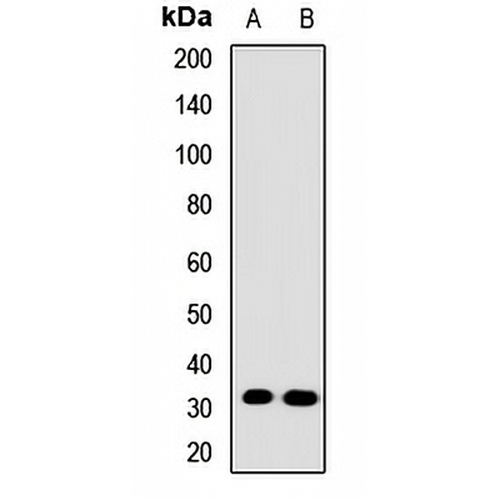 GPM6A Rabbit Polyclonal Antibody