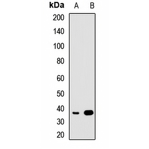 CRALBP Rabbit Polyclonal Antibody