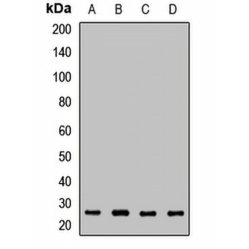 VPS28 Rabbit Polyclonal Antibody