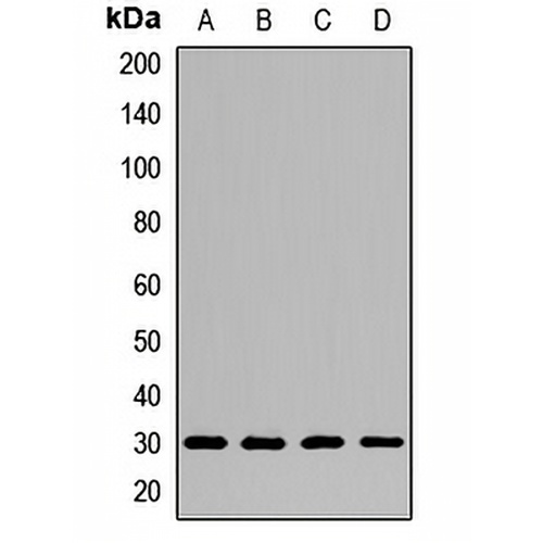 CLPP Rabbit Polyclonal Antibody