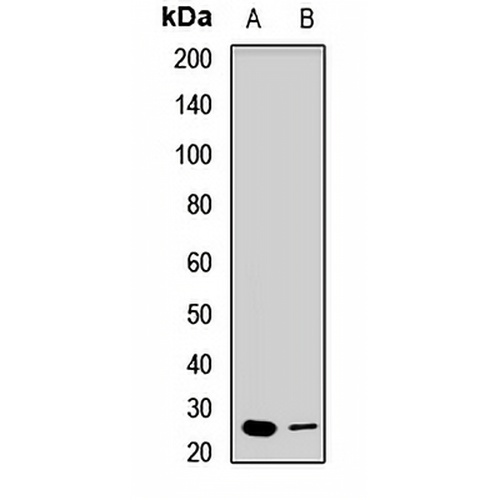 EXOSC4 Rabbit Polyclonal Antibody