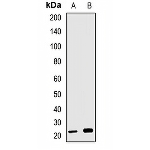 GINS2 Rabbit Polyclonal Antibody