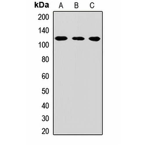 CPSF2 Rabbit Polyclonal Antibody