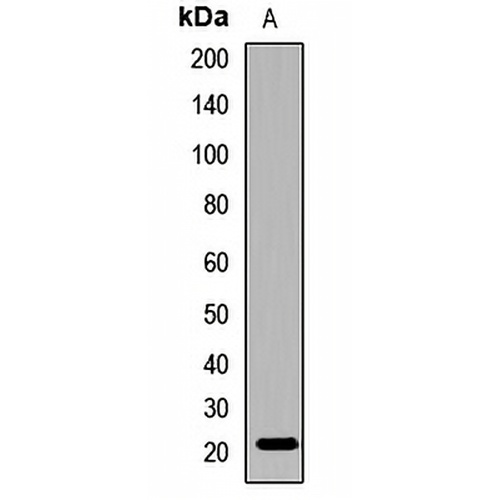 Gamma-C-crystallin Rabbit Polyclonal Antibody