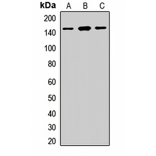 Desmoglein 2 Rabbit Polyclonal Antibody