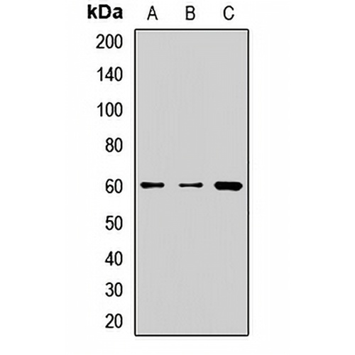 FTCD Rabbit Polyclonal Antibody