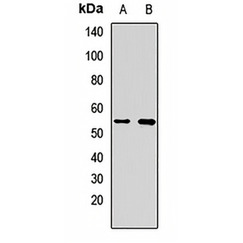 ME2 Rabbit Polyclonal Antibody