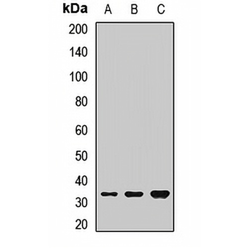 PHOX2B Rabbit Polyclonal Antibody
