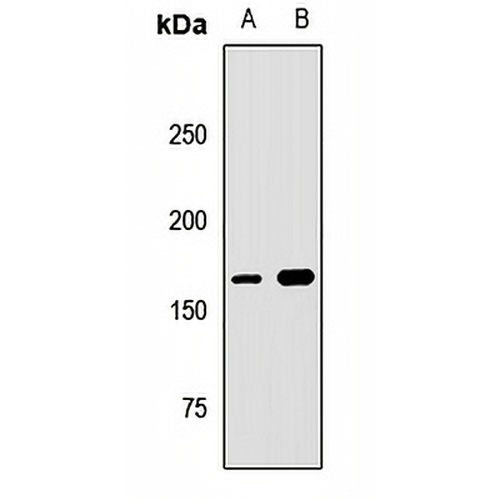 UACA Rabbit Polyclonal Antibody