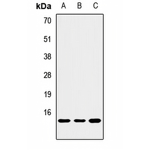 NOXA Rabbit Polyclonal Antibody