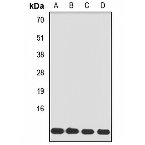 Tim8A Rabbit Polyclonal Antibody
