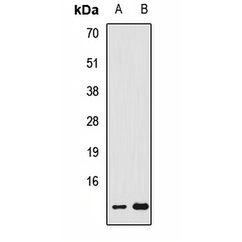 FDX1 Rabbit Polyclonal Antibody