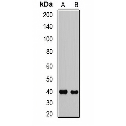 HOXA13 Rabbit Polyclonal Antibody