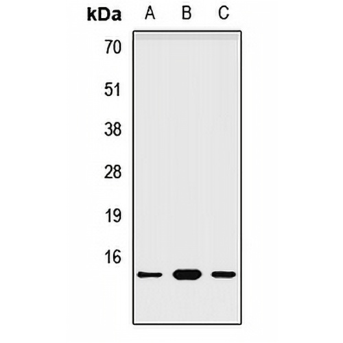 NDUFA6 Rabbit Polyclonal Antibody